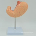 PNT-0459 Human Stomach Anatomy Structure Model 2 Parts